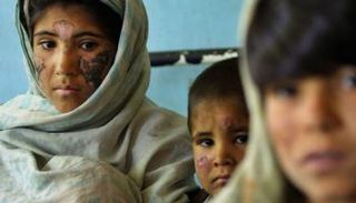 داء الليشمانيات الجلدي لا يزال يمثل خطورة في شرق المتوسط