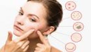 ما هي البشرة المختلطة وهل تحتاج لعناية خاصة؟