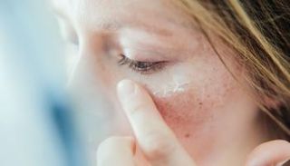 جفاف البشرة يعرض الإنسان لمخاطر عدة - أرشيفية