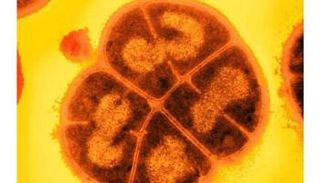 البكتيريا تم تعريضها لظروف المريخ لاختبار إمكانية بقائها