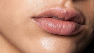 يجب حماية الشفاه من الأشعة فوق البنفسجية