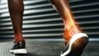 الفصال العظمي.. أخطاء تهدد "مفاصل" الشباب بالتآكل