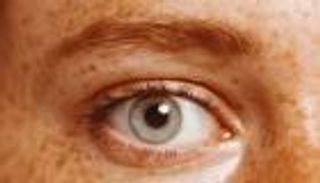 الشعر الأحمر والعيون الزرقاء.. تعرف على سر الجمال النادر