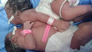 التوأم إيمان وأمينة