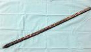 سيخ يخترق صدر مصري ويخرج من ظهره.. ما زال "حي يزرق"