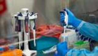 الكويت تكتشف أول إصابة بالكوليرا