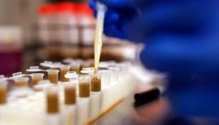 زراعة البراز - أرشيفية