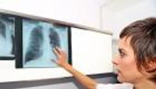 أسباب وأعراض الانسداد الرئوي.. احذر زيادة الوزن