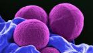 علماء يقهرون مكر البكتيريا.. وباحث مصري: خطوة للعلاج