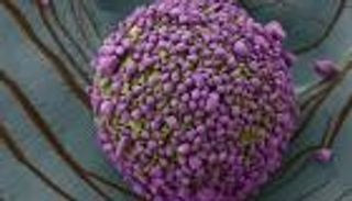 عالمة أمريكية لـ"العين الإخبارية": "فيتامين أ" المغلَّف جاهز للتسويق