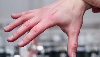 تورم الأصابع يمكن أن يشير إلى خلل وظيفي في القلب