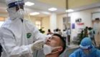 لماذا نجت بعض الدول من قسوة كورونا؟ علماء يكشفون السر