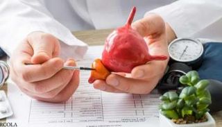 التقنية الجديدة مفيدة في علاج أورام البروستاتا- تعبيرية