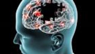 الوقاية من مرض ألزهايمر تبدأ من اللثة.. كيف ذلك؟