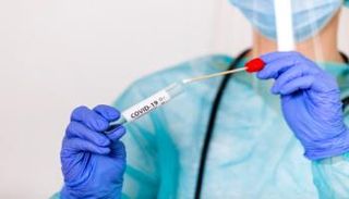 اختبار فيروس كورونا- أرشيفية