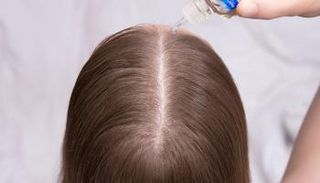 نوع سيروم فروة الشعر يختلف حسب الاحتياج المطلوب