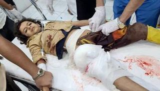 طفل أصيب في قصف سابق لمليشيات الحوثي على مأرب