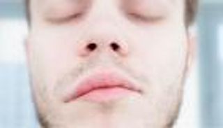 شلل الوجه.. الأعراض والأسباب والعلاج