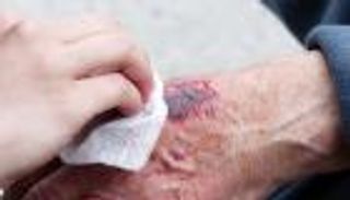 جروح كبار السن.. نصائح للشفاء السريع