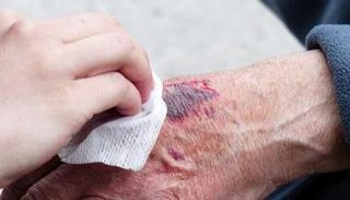 جروح كبار السن المزمنة تتطلب استشارة الطبيب