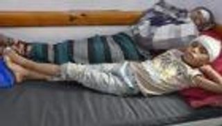 47 طفلا.. "يونيسف" تكشف حصيلة ضحايا أطفال اليمن منذ 2022