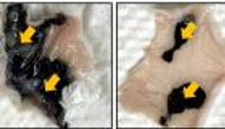 وشم القولون.. باحثون يبتكرون حبرا محسنا