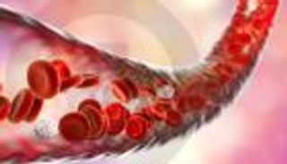 الأوعية الدموية.. 4 أسباب تقودك إلى السكتات الدماغية (إنفوجراف)