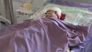 سيدة يمنية أصيبت برصاص قناص حوثي - أرشيفية