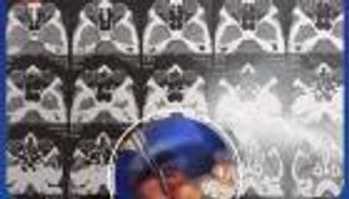 استخراج نصف قلم من عين طفل مصري.. كيف حدث هذا؟