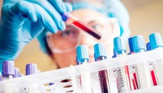  الإنتان ينجم عن انتشار التورّمات أو الالتهابات في الجسم