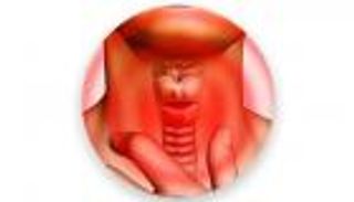 4 نصائح مهمة لمريض قصور الغدة الدرقية (إنفوجراف)‎‎