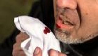 علامات تنذر بخطر السرطان.. راقب السعال والبول والبراز