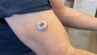 رقعة بالجلد تحدد مستويات الكحول والجلوكوز في وقت واحد