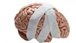 إصابات الدماغ الرضية.. الأعراض والتشخيص والعلاج (إنفوجراف)