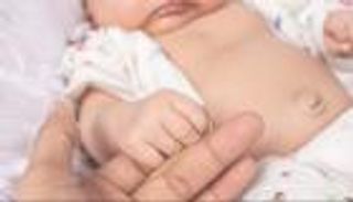 الفتق السري لدى الرضع.. متى يستلزم الخضوع للجراحة؟