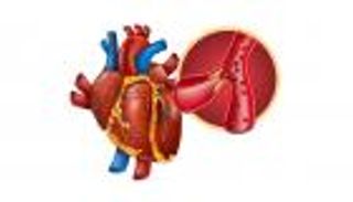 إنفوجراف.. نصائح للوقاية من جلطات القلب المتكررة