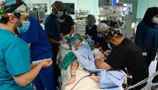 جراحة فصل التوأم 