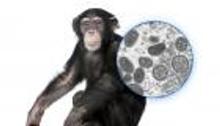 جدري القرود.. عدوى نادرة تهدد العالم (إنفوجراف)