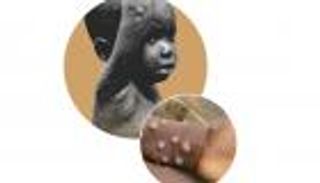 جدري القرود.. 64 عاما من الغموض (إنفوجراف)