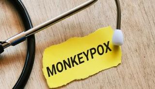 فيروس جدري القرود - أرشيفية