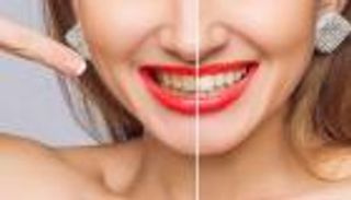 10 أطعمة مسؤولة عن اصفرار الأسنان.. أبرزها التوت والكريز والصلصة