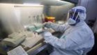 رقعة جدري القرود تتسع.. 22 إصابة في ساعات معدودة