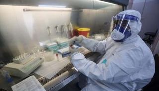 فيروس جدري القرود يواصل الانتشار حول العالم