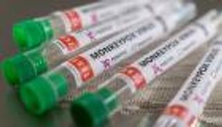 خريطة انتشار جدري القرود حول العالم.. 123 إصابة مؤكدة