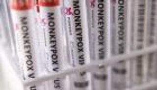 النمسا تسجل أول إصابة بفيروس جدري القرود