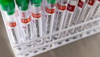 جدري القرود ظهر في 19 دولة حول العالم