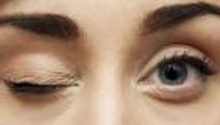 مخاطر ارتعاش الجفن المتكرر.. 8 أسباب و4 نصائح