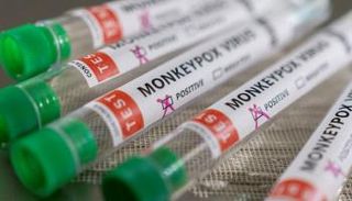 جدري القرود بدأ ينتشر خارج المناطق الموبوءة