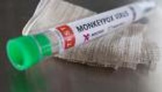 المغرب خال من جدري القرود بعد فحص 3 حالات محتملة