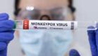 ويلز تسجل أول إصابة بجدري القرود